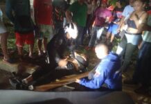 Motorizado sufre politraumatismos durante accidente en Tucacas