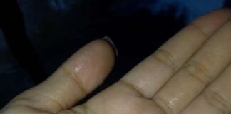 Lluvia con granizo en Dabajuro este 3-Oct +VIDEO