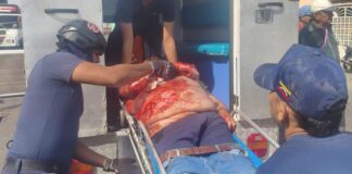 Vídeo| Reportan un comerciante muerto por arrollamiento en Coro