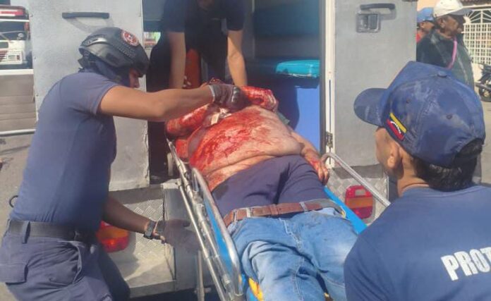 Fallecido por arrollamiento 2