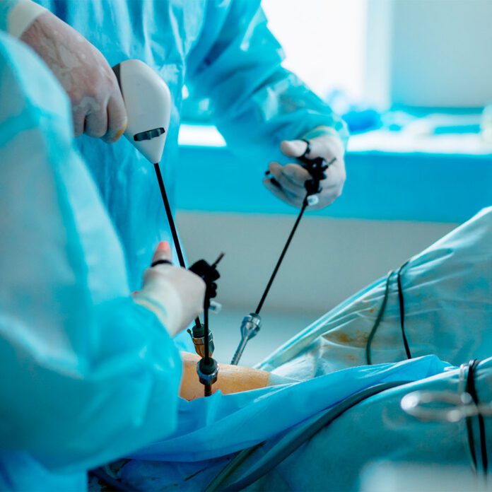 cirugía-licenciada-Bypass-gastrico Coro | Investigan muerte de licenciada tras días de someterse a un bypass gástrico