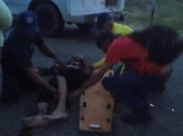 Sexagenario sufre traumatismo craneoencefálico severo en accidente de tránsito en Capatárida