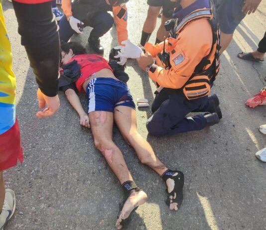 Colisión entre moto y Encava dejó un fallecido la tarde de hoy domingo en Coro