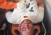 Motorizado bajo los efectos del alcohol casi pierde la vida en Las Antillas de Guacurebo