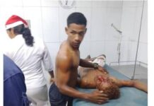 Motorizados chocaron con objeto fijo en Tucacas