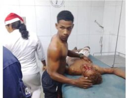 Motorizados chocaron con objeto fijo en Tucacas