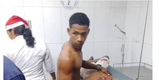 Motorizados chocaron con objeto fijo en Tucacas