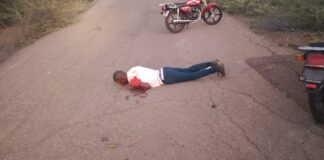 Motorizado sufrió politraumatismos, escoriaciones y traumatismo facial