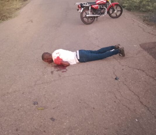 Motorizado sufrió politraumatismos, escoriaciones y traumatismo facial