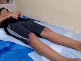 Municipio Falcón| Adolescente rodó en la bajada de El Amparo