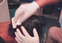 Punto Fijo| Adolescente sufrió un botellazo en la cabeza