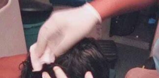 Punto Fijo| Adolescente sufrió un botellazo en la cabeza