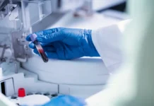 Alerta epidemiológica | India lucha por contener brote del letal virus Nipah India lucha por contener brote del letal virus Nipah