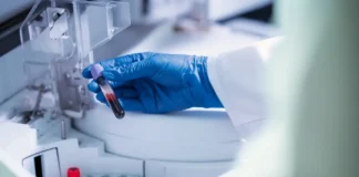 Alerta epidemiológica | India lucha por contener brote del letal virus Nipah India lucha por contener brote del letal virus Nipah