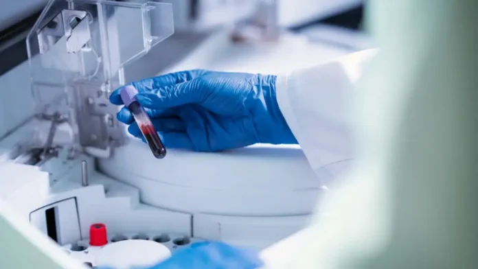 India lucha por contener brote del letal virus Nipah