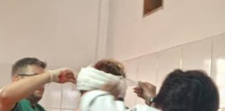 Su hermano le «partió» la frente con un palo durante una riña en Punto Fijo