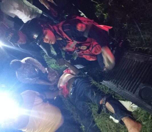 Buchivacoa| Mujer falleció en accidente de tránsito