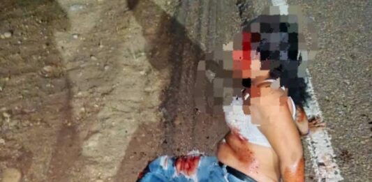 Municipio Colina| Motorizados colisionaron con una grúa