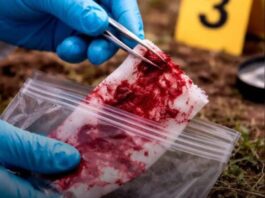 Caracas| «El Pocho» falleció en intervención legal