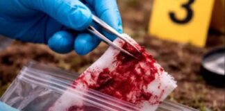 Caracas| «El Pocho» falleció en intervención legal