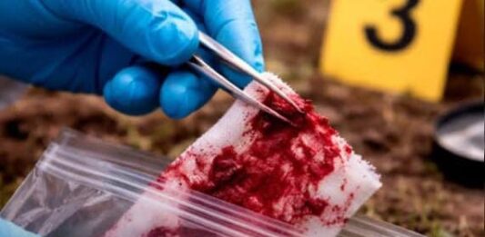 Caracas| «El Pocho» falleció en intervención legal