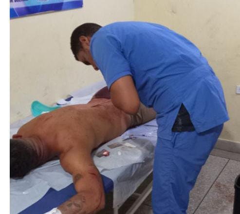Municipio Falcón| Herido por arma blanca