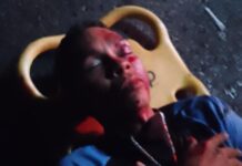 Coro| Mototaxista chocó con un poste