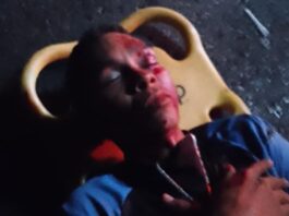 Coro| Mototaxista chocó con un poste