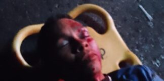 Coro| Mototaxista chocó con un poste