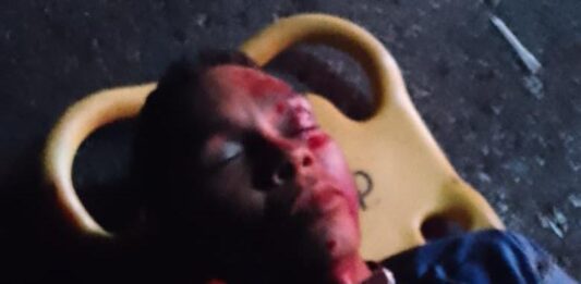 Coro| Mototaxista chocó con un poste