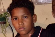 Municipio Jacura| Niño de diez años muere arrollado por una moto