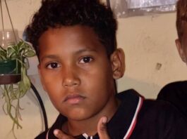 Municipio Jacura| Niño de diez años muere arrollado por una moto