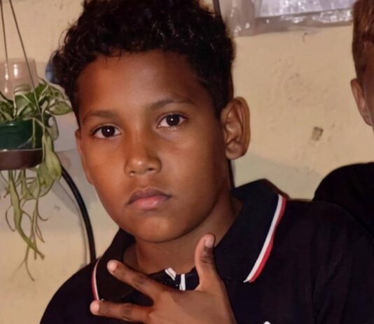 Municipio Jacura| Niño de diez años muere arrollado por una moto