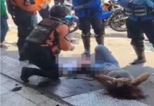 Valencia| Una mujer perdió parte de su pierna izquierda tras ser arrollada