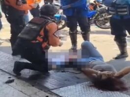 Valencia| Una mujer perdió parte de su pierna izquierda tras ser arrollada