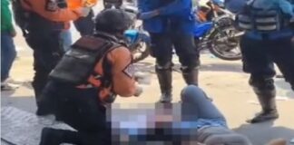 Valencia| Una mujer perdió parte de su pierna izquierda tras ser arrollada