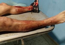 Municipio Colina| Hombre se quitó la vida