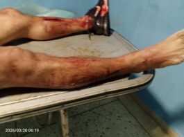 Municipio Colina| Hombre se quitó la vida