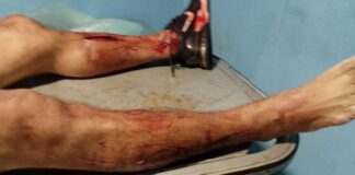 Municipio Colina| Hombre se quitó la vida