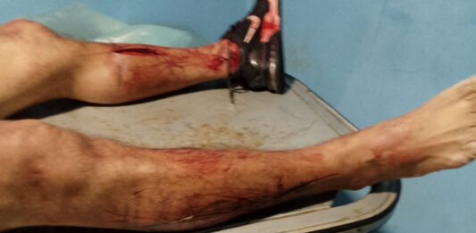 Municipio Colina| Hombre se quitó la vida