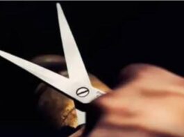 Coro| Mujer fue atacada por su expareja con una tijera