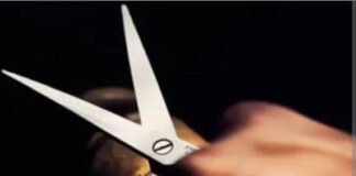 Coro| Mujer fue atacada por su expareja con una tijera