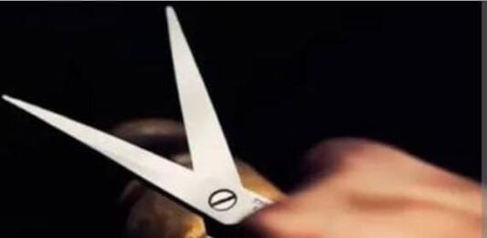 Coro| Mujer fue atacada por su expareja con una tijera