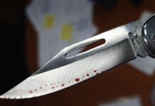 Coro| Lo cortaron con una navaja en una riña familiar