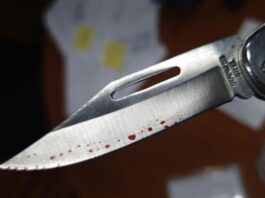 Coro| Lo cortaron con una navaja en una riña familiar