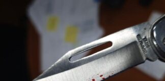 Coro| Lo cortaron con una navaja en una riña familiar