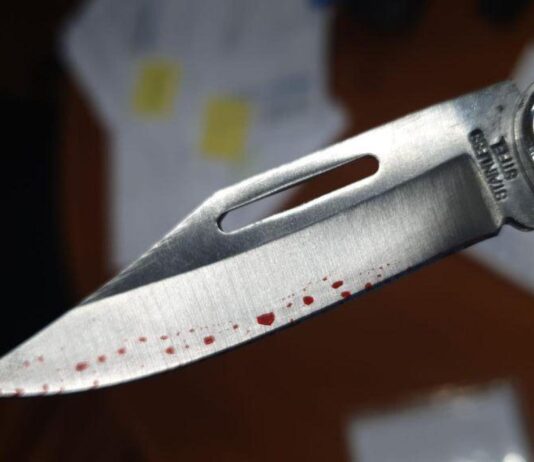 Coro| Lo cortaron con una navaja en una riña familiar