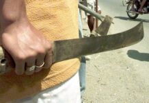 Punto Fijo| Le dieron un machetazo en la cabeza