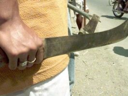 Punto Fijo| Le dieron un machetazo en la cabeza