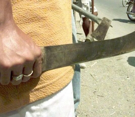 Punto Fijo| Le dieron un machetazo en la cabeza